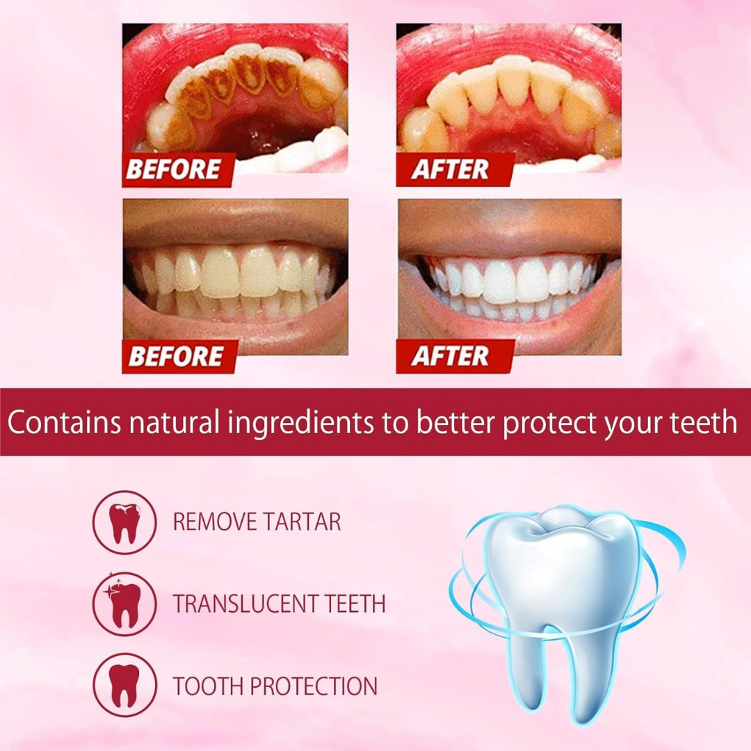 SP 4 UltraBrightening Toothpaste, Advanced Whitening Formula for Stain Removal and Enamel Protection| Fresh Mint Flavor| 120g